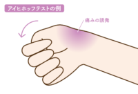 アイヒホッフテストの例